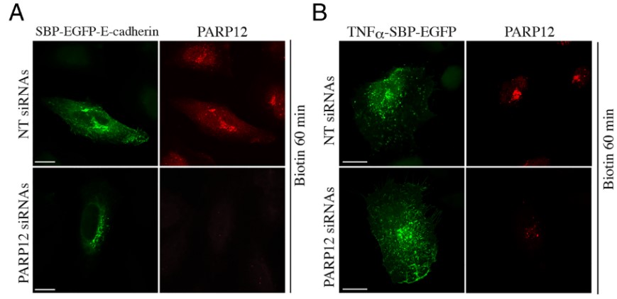 Exocytosis of E-cadherin is specifically controlled by PARP12 and Golgin-97.jpg